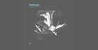Refract